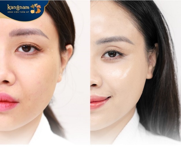 Da trở nên mịn màng hơn, và các vết thâm do tác động của môi trường giảm đi đáng kể