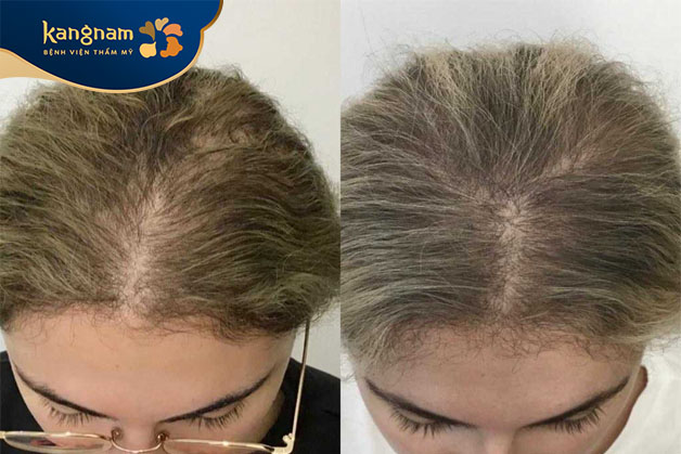 Tóc chắc khỏe, mọc đều