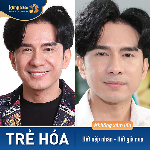 Ca sĩ Đan Trường rất hài lòng với diện mạo mới