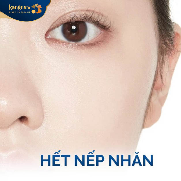 Trẻ hóa da xóa mờ nếp nhăn, dấu hiệu lão hóa