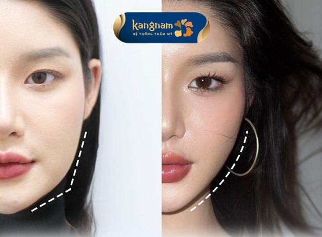 Trẻ hóa da phù hợp với nhiều đối tượng khác nhau