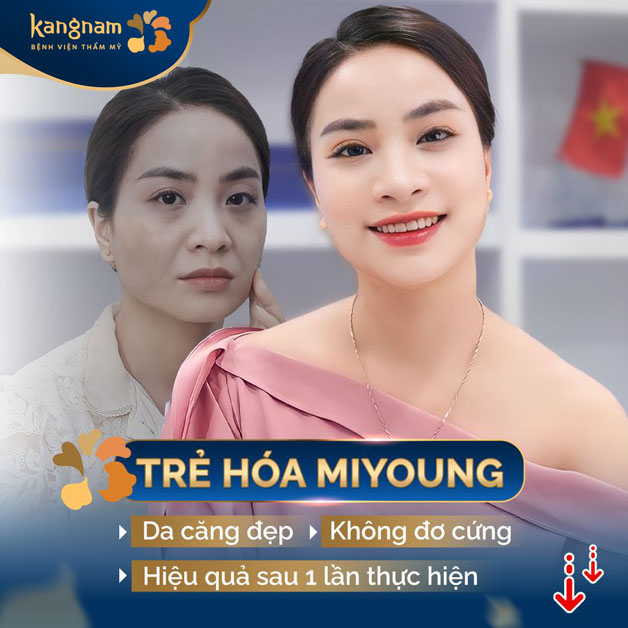 Căng da bằng chỉ Mi Young không phẫu thuật