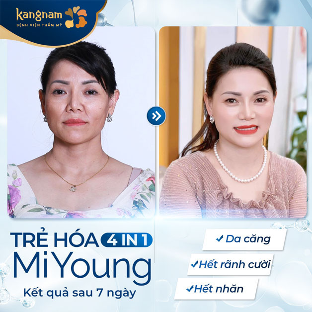 Da căng trẻ thêm tự tin