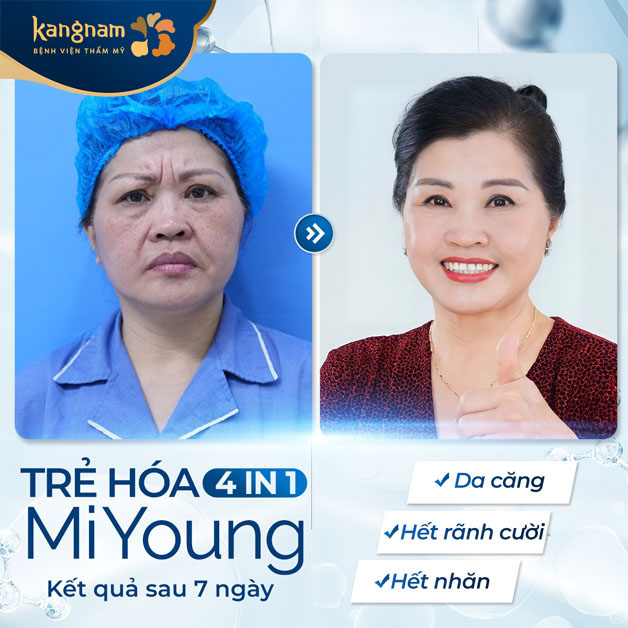 Xóa nhăn nhanh chóng sau 1 lần thực hiện