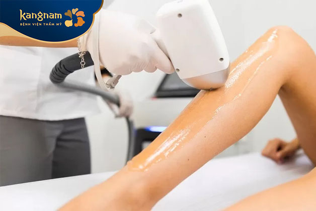 Loại bỏ lông chân giúp nâng cao sự tự tin cho mọi người