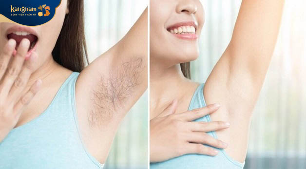 Lông nách rậm rạp ảnh hưởng đến sự tin