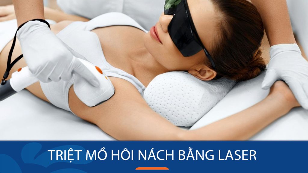 Triệt mồ hôi nách bằng laser có hết không? Chuyên gia phân tích