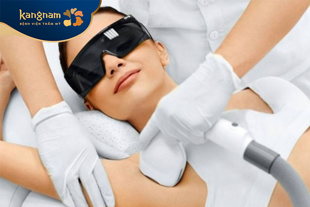 Triệt mồ hôi nách bằng laser