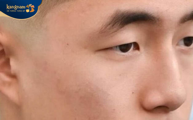 Đàn ông có lông mày chổi xể thường có mối quan hệ thân thiết với anh chị em trong gia đình, thời trẻ dưa giả, cuối đời nghèo túng