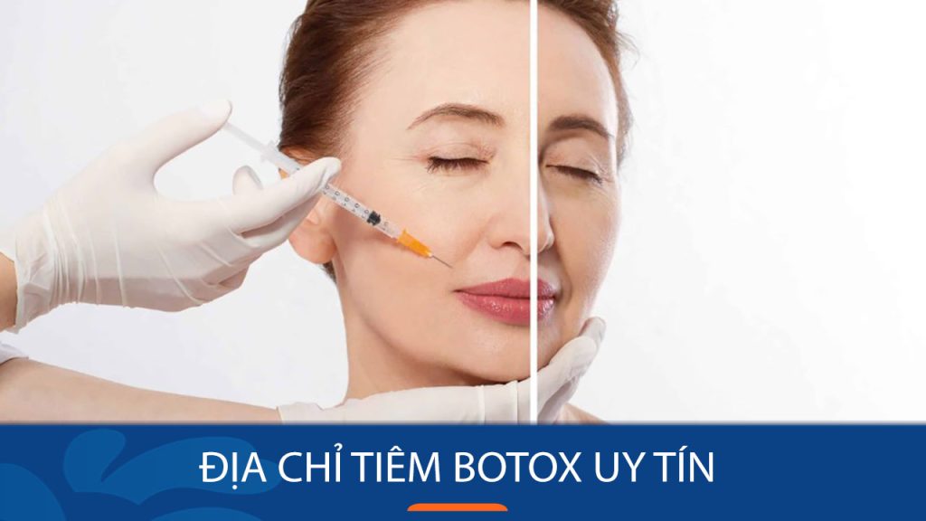 Tiêm botox an toàn, hiệu quả – Lựa chọn địa chỉ uy tín Hà Nội/TP.HCM