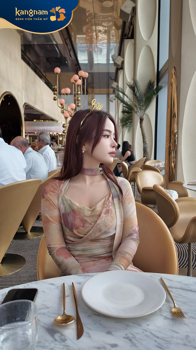 Bạn Chole Nguyễn gửi feedback sau khi nâng mũi tại Kangnam