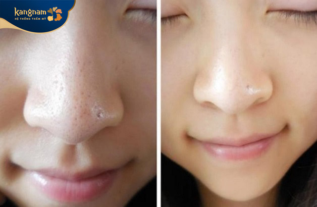 Khách hàng sẵn sàng chi trả số tiền cao hơn để được trải nghiệm dịch vụ tốt