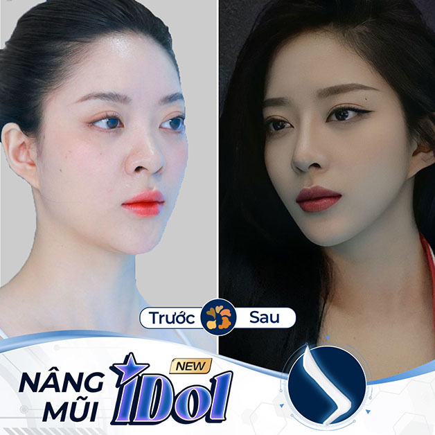 Khách hàng cảm thấy hài lòng với chiếc mũi mới