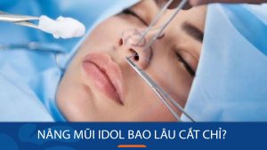 Nâng mũi Idol bao lâu cắt chỉ? Hướng dẫn chi tiết từ A đến Z