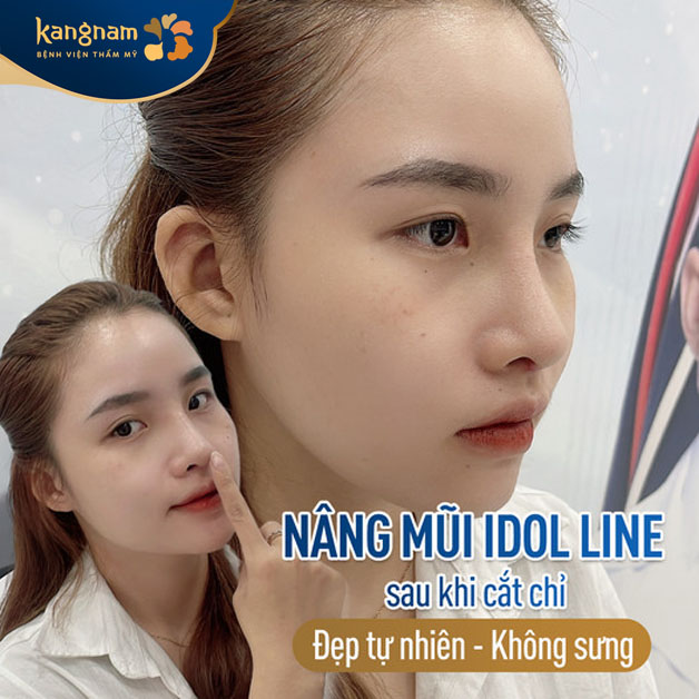 Dáng mũi cao bay nhẹ nhàng, mềm mại tự nhiên