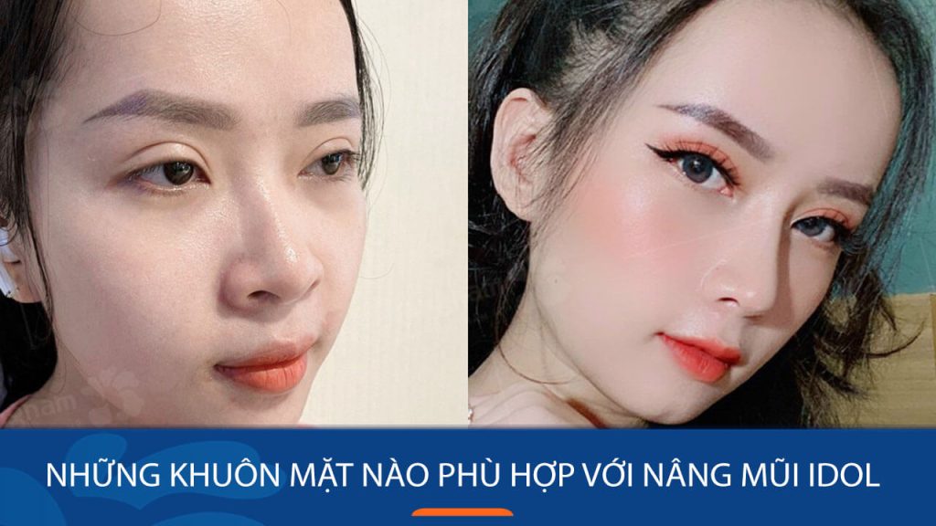 Những khuôn mặt nào phù hợp với Nâng mũi Idol: Bác sĩ tư vấn