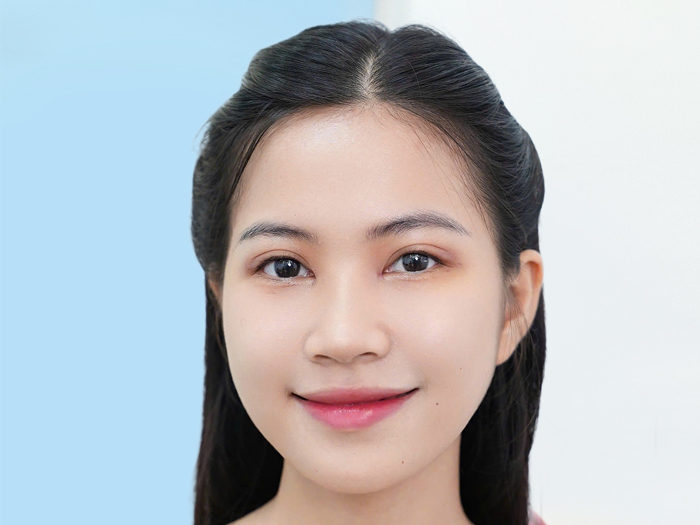 Kết quả thấy nhanh, không cần nghỉ dưỡng