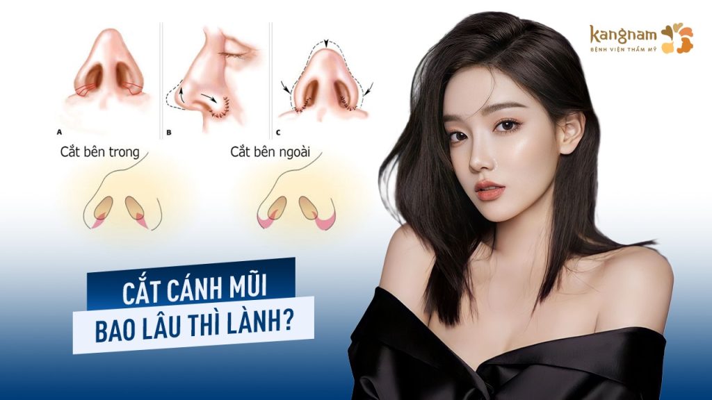 Cắt cánh mũi bao lâu thì lành? Mốc hồi phục & cách mau lành