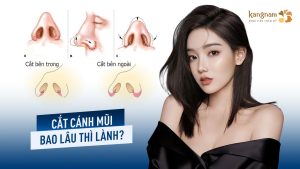 Cắt cánh mũi bao lâu thì lành? Mốc hồi phục & cách mau lành