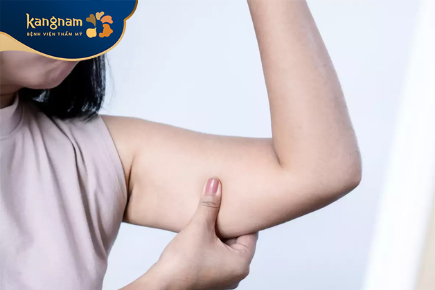 Người có bắp tay thô, to nên tiêm thon gọn bắp tay