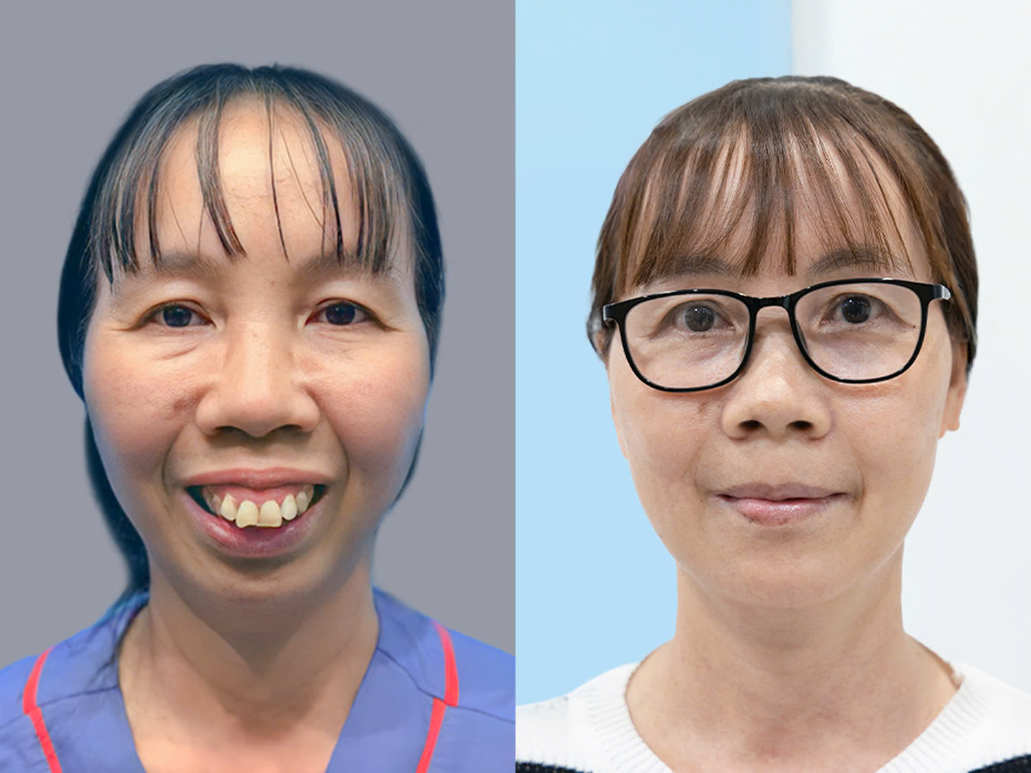 Cô Vũ Thị Thảo minh chứng chỉnh hàm ở độ tuổi 50