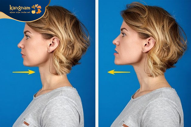 Bài tập giãn cằm giúp cải thiện gò má cao hiệu quả