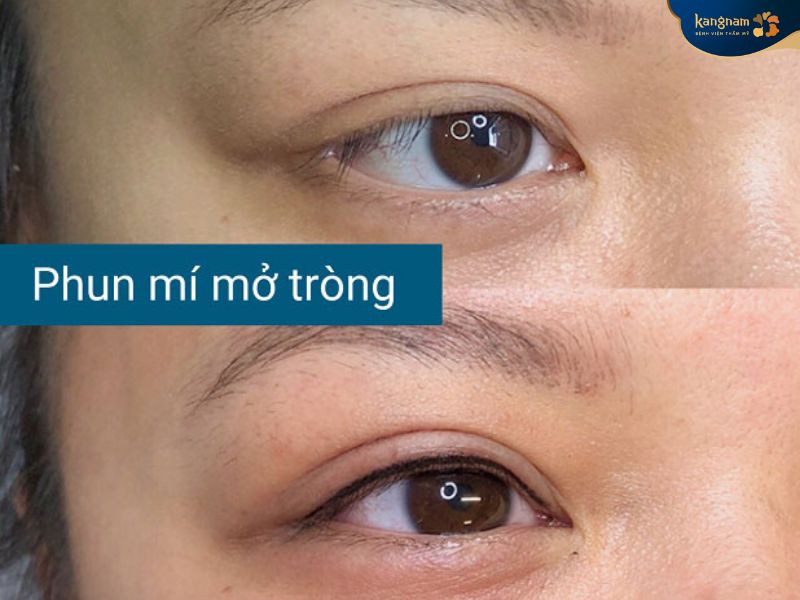 Dịch vụ phun mí mở tròng giúp chỉ em không cần kẻ mí mắt hàng ngày