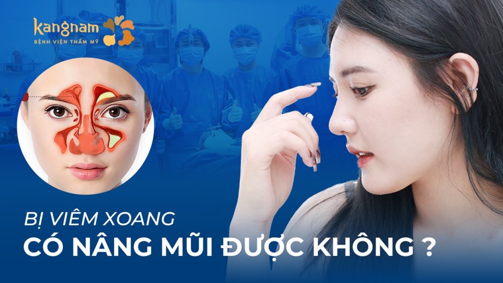 Bị viêm xoang có nâng mũi được không? Giải đáp thắc mắc từ chuyên gia