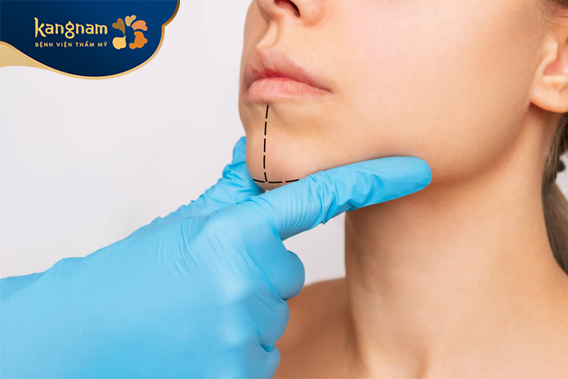 Các phương pháp hút mỡ mặt