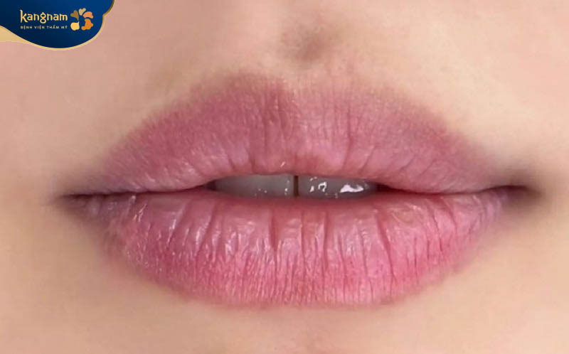Môi lên màu không đều, chỗ đậm chỗ nhạt