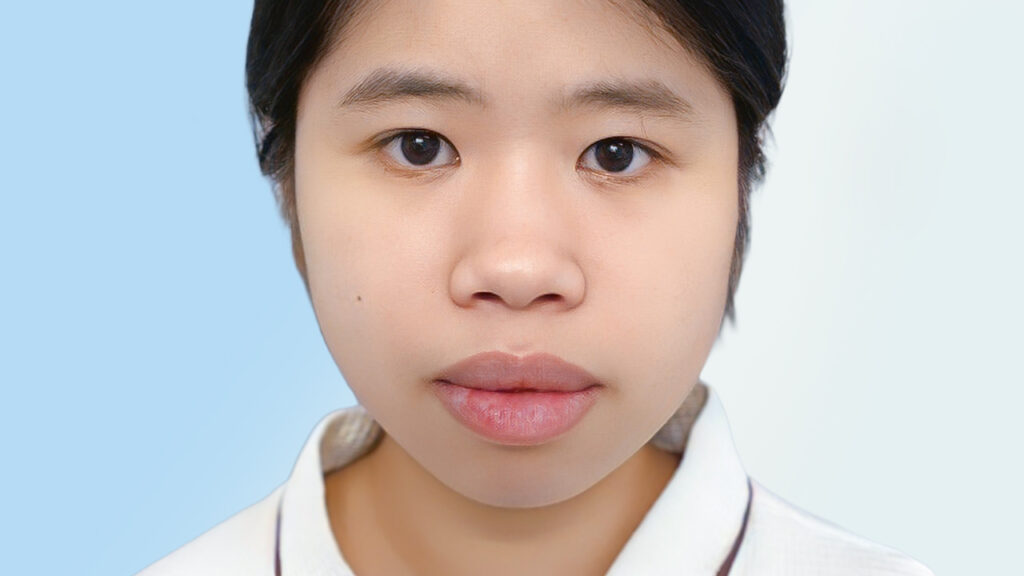 Cằm ngắn tròn là gì? Gợi ý kiểu tóc, trang điểm và cách cải thiện dáng cằm