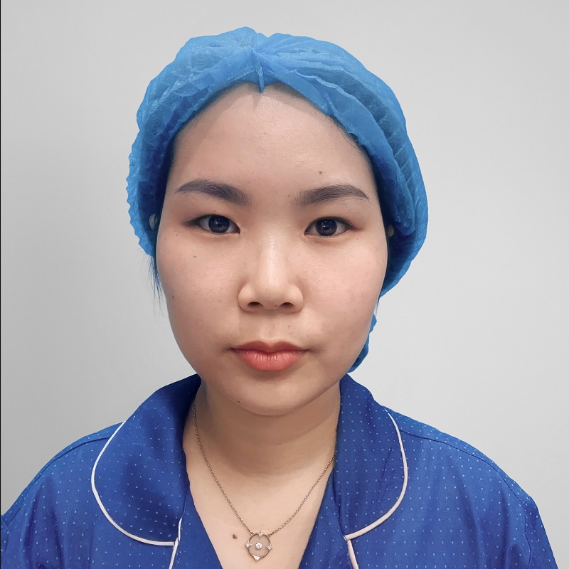 Nếp mí bị bung, hằn sẹo, nhắm mắt là lộ dấu vết cắt mí