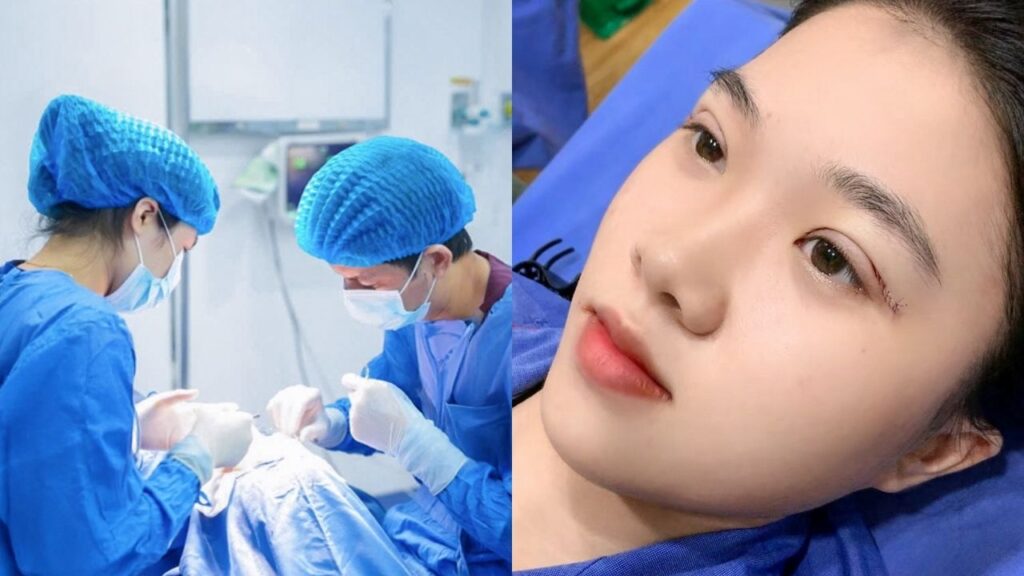 Cắt mí mắt có đau không? Bí quyết không cảm thấy đau