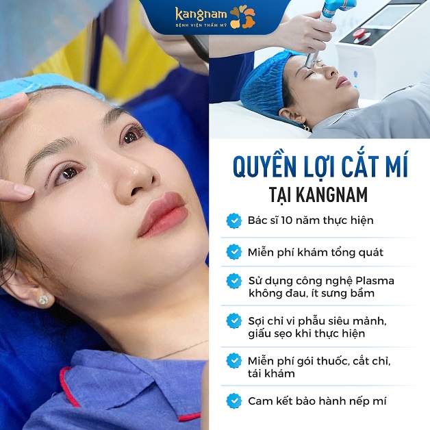 Khách hàng được hưởng nhiều quyền lợi khi cắt mí tại Kangnam