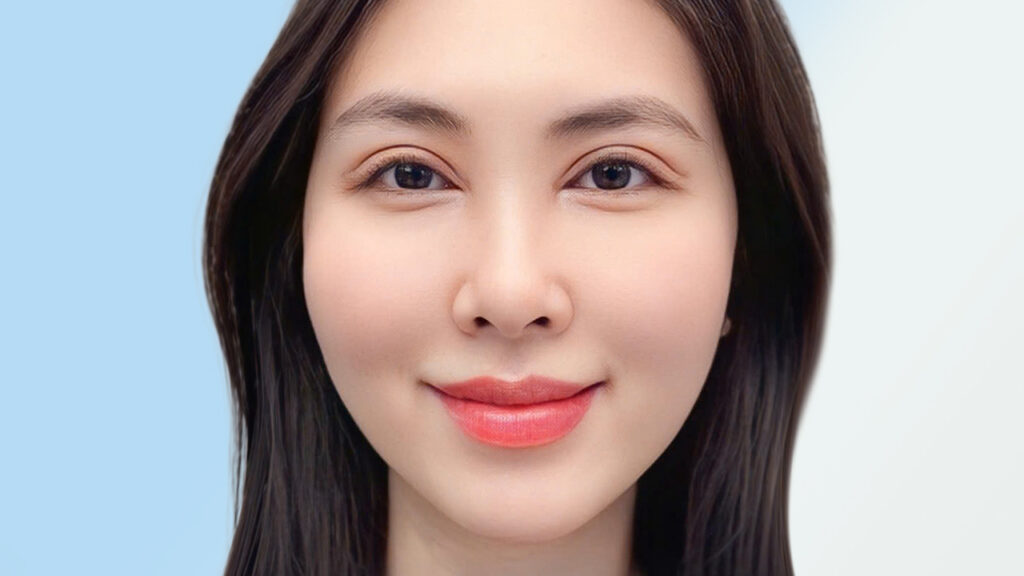 Cắt Mí Mini Deep: Giải pháp hoàn hảo cho đôi mắt một mí, sụp mí