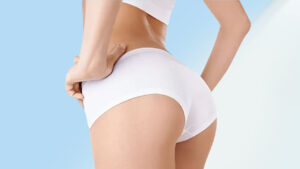 Cấy mỡ hông : Bí quyết cho vòng eo đầy đặn