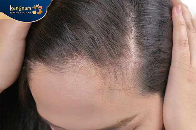 Hạn chế dùng sản phẩm chăm sóc tóc