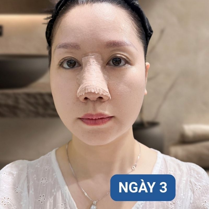 Giữ mũi sạch là nguyên tắc quan trọng nhất