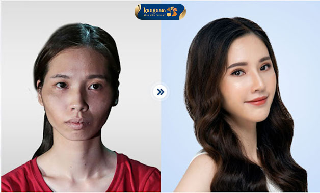 Thí sinh lột xác Phan Thị May và gương mặt cân đối