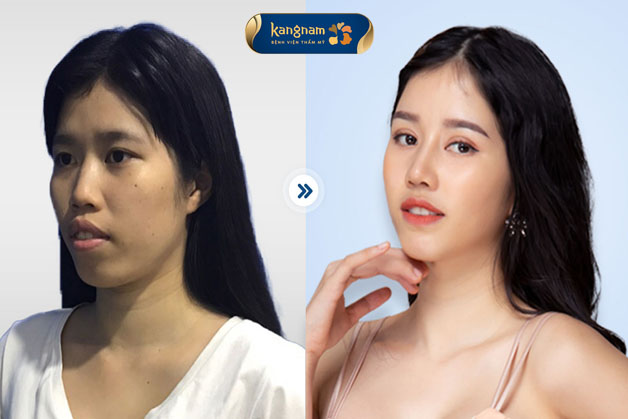 Ngô Quế An lột xác trở nên xinh xắn, tươi tắn và tự tin hơn