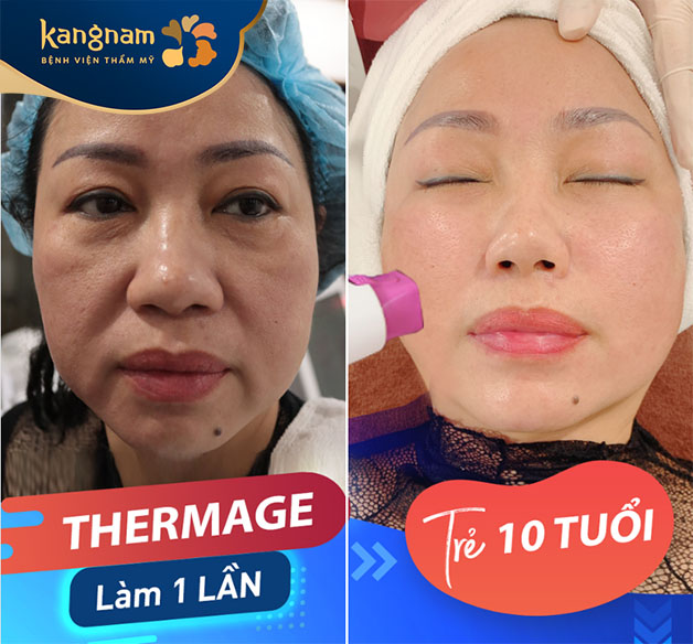 Làn da săn chắc và căng bóng hơn