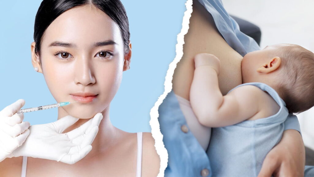 Đang cho con bú tiêm botox gọn hàm được không? Bác sĩ kangnam giải đáp