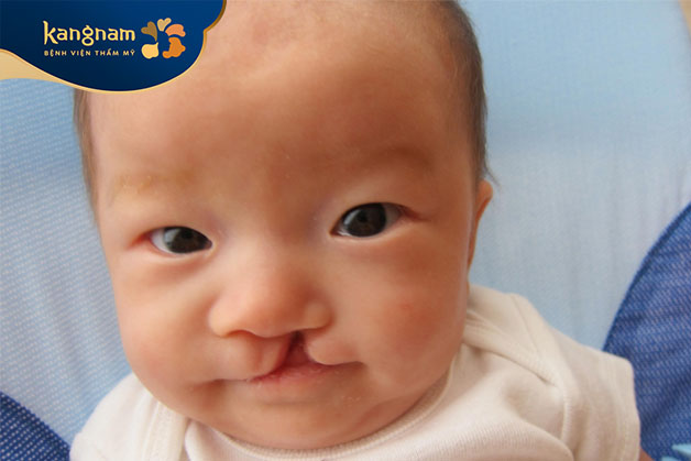 Khả năng trào ngược dạ dày ở trẻ