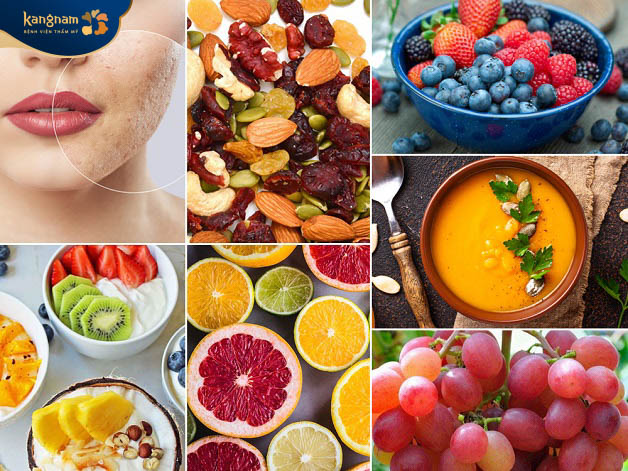 Bổ sung chế độ ăn uống lành mạnh