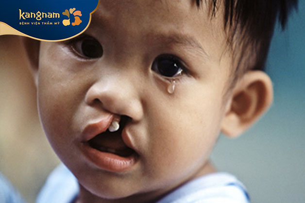 Trẻ từ 12 tháng trở lên hoặc sớm hơn