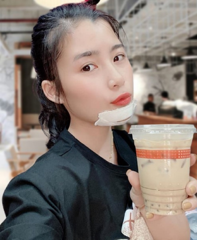 Sau vài ngày vùng cằm sẽ hết đau