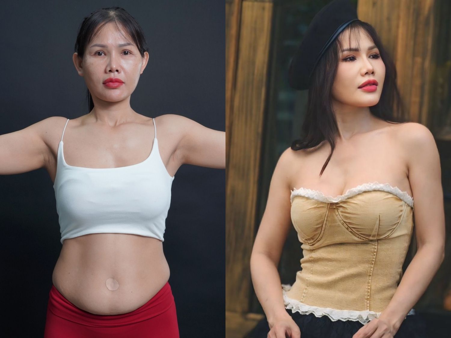 Chị Hoàng Diễm sau khi giảm mỡ thành công tại Kangnam