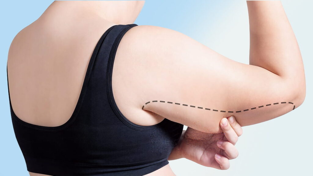 5 Cách giảm mỡ bắp tay Cấp Tốc – Thu nhỏ vai, bắp tay nhanh nhất