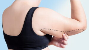 5 Cách giảm mỡ bắp tay Cấp Tốc – Thu nhỏ vai, bắp tay nhanh nhất