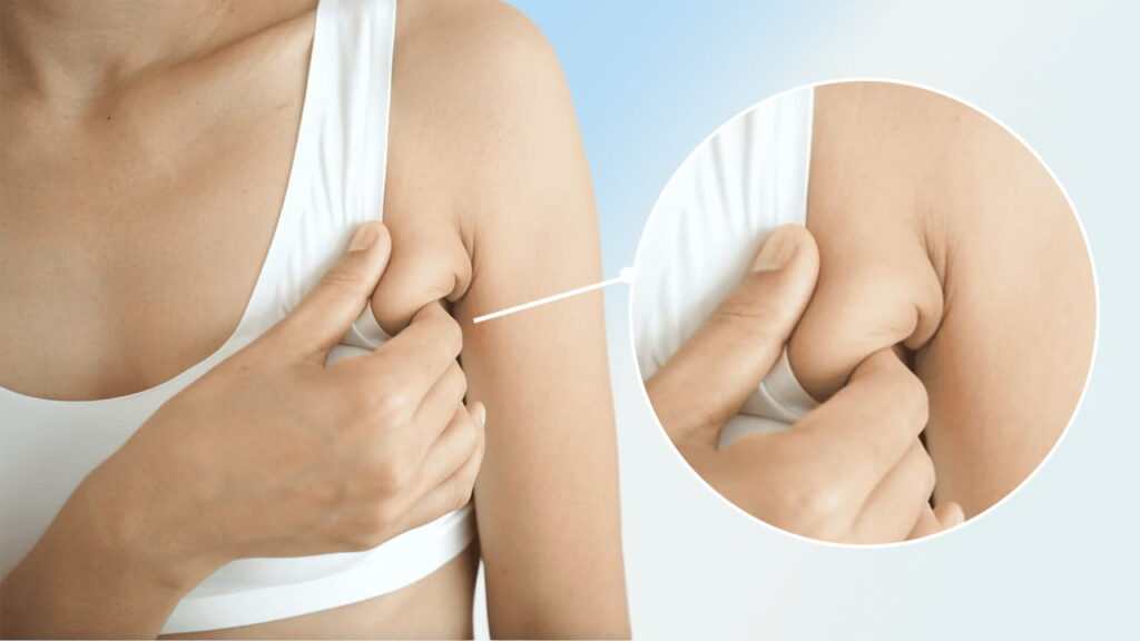 7 Cách giảm mỡ nách Cấp Tốc – Loại bỏ mỡ thừa hiệu quả